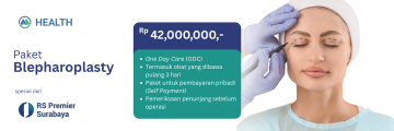 paket-blepharoplasty-operasi-kelopak-by-rs-premier-surabaya